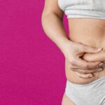 A Guide to Tummy Tuck Transformation